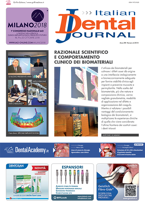Italian dental Journal giugno 2018